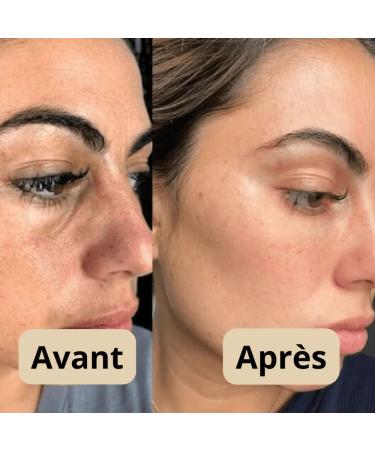 Lumeva Peel Shot Lumeva Visage Point Noir Exfoliant Visage Cor en - S rum Exfoliant Riz Noir & Blanc Nettoyage Profond des Pores et Points Noirs Pour Tous Types de Peau - 80 ml 2 flacons - Buy Online on GoSupps.com