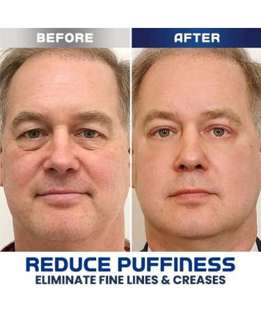 OpenEyes Awaken Peptide Lifting Eye Gel by Nordizoe - 2 Pack - Buy Online on GoSupps.com