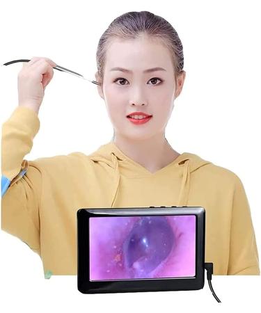 Yuidaaavzz Ear Wax Removal Tool Ear Cleansing Tool Set with 4.3 inches 3.9mm Ear Cleaning Camera and Soft Silicone Earwax Remover Tool (Color : Blue) (Blue) - Buy Online on GoSupps.com