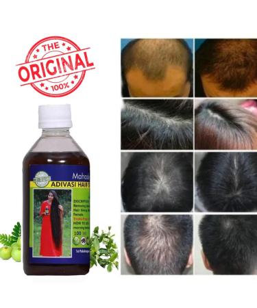 Adivasi Herbal Hair Oil | Pure Ayurvedic Herbs for Stronger Hair - International Shipping Available - Buy Online on GoSupps.com