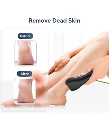 Electric Foot Callus Remover Set - 10-Piece Waterproof Rechargeable Kit for Smooth Feet | Digital Display & Effective Dead Skin Removal - Buy Online on GoSupps.com
