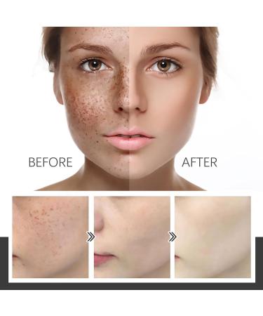 Dark Spot Remover for Face Hyaluronic Acid Dark Spot Correcting Serum Anti Aging Face Serum for Women Nicotinamide Dark Spot Correcting Glow Serum Anti Spot Face Serum and Oil Skin Moisturizer-30ml - Buy Online on GoSupps.com