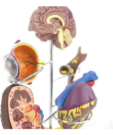 Diabetes Model Set Diabetes ICal Model Human Organ Coronary Artery Thrombosis Model Arteriosclerosis in Vitro - Buy Online on GoSupps.com