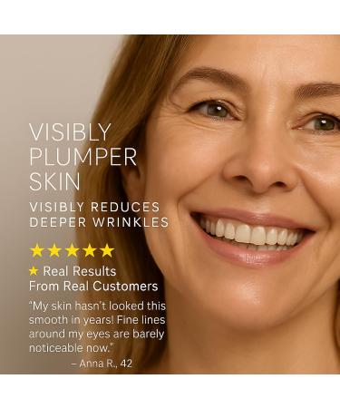 Mesoderm RX Collagen Revitalizer Nourishing Cream with Retinol Peptides & Hyaluronic Acid Lightweight Hydrating Anti ageing-Cream for Smooth Radiant Glowing Skin 1.06 oz - Buy Online on GoSupps.com