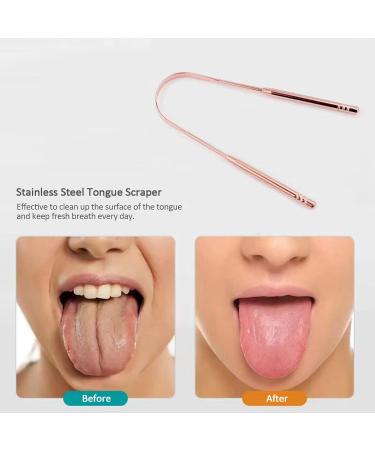 Layhou 2-Piece Stainless Steel Tongue Cleaner Set with Metal Storage Box - Fresh Breath Tongue Scraper & Mouthwash Tool - Buy Online on GoSupps.com