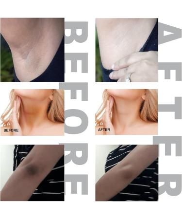 BELA DIVO Dark Spot Cream | Natural Underarm & Intimate Cream | Dark Spot Corrector for Face & Sensitive Skin | Hyperpigmentation & Even Skin Tone | Alpha Arbutin & Niacinamide (1.7oz/50ml) - Buy Online on GoSupps.com