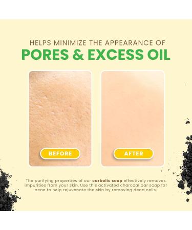 Earthmade Assorted Natural Soap Bars - KINA & BLACK SEA Combo (6oz Each) - Eco-Friendly & Handmade International Shipping - Buy Online on GoSupps.com