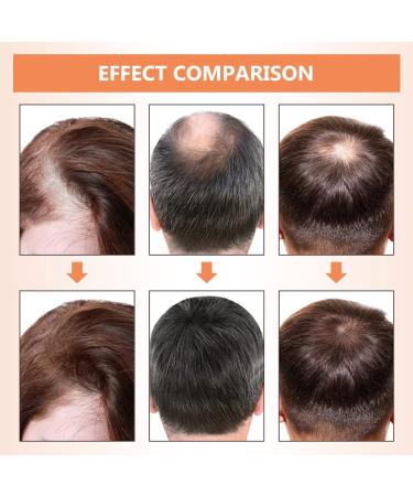 Ginger Hair Growth Shampoo & Conditioner Set | Anti Hair Loss, Promotes Fast Hair Growth, Moisturizes & Strengthens Thin/Damaged Hair - 14.67 oz - Buy Online on GoSupps.com