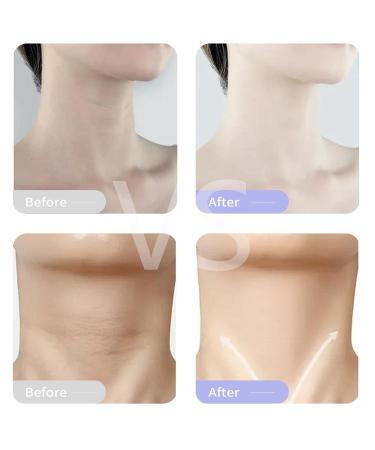 Neck Firming Cream - Mango Infused Moisturizer for Tightening Wrinkle Reduction & Lasting Hydration | Best Neck Cream for Firmness - Buy Online on GoSupps.com