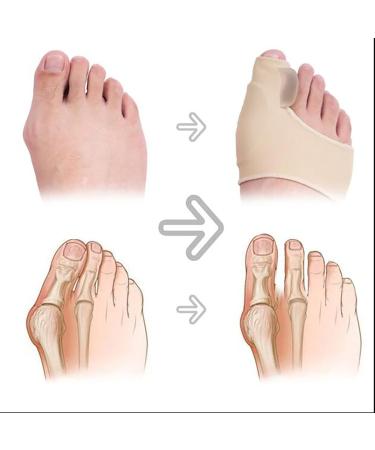 ALINZO Bunion Corrector - Thin Bunion Socks Bunion Relief for Women & Men Orthopedic Bunion Corrector for Big Toe Straightener Day & Overnight Support - Buy Online on GoSupps.com