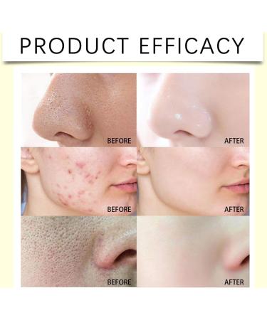 JIAOY Facial peeling with vitamin C and turmeric luminous facial peeling with vitamin C scrub facial cleanser with turmeric scrub removes blackheads improves dark spots tower*1 1 x tormer - Buy Online on GoSupps.com