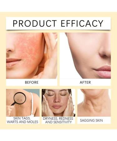  JIAOY AllyBee 4-Pack Bee Venom Skin Care Creams - All-in-One Care Cream - Bee Venom - Versatile Anti-Wrinkle Firming Natural Serums for All Skin Types - Buy Online on GoSupps.com