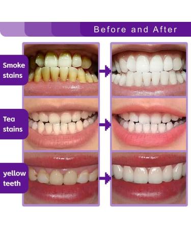 Bymolia Fluoride Free Toothpaste Appropriate for Sensitive Teeth for Adult Kids Oral Care - Whitening* Refresh Mint 3.5 oz - Buy Online on GoSupps.com