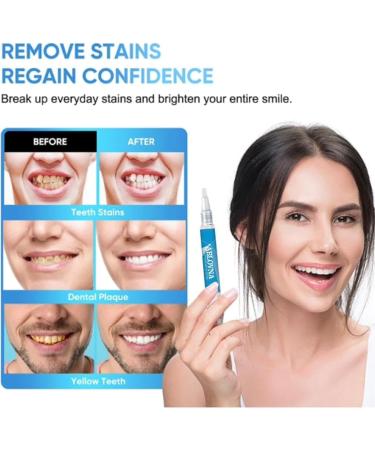 Teeth Whitening Pen 4 Pack Brighten Your Smile in Just 1 Week with Tooth Whitening Pens Fast Gentle Enamel Safe Whitening Gel for White Teeth in Mess Free Applicator Pens - Buy Online on GoSupps.com