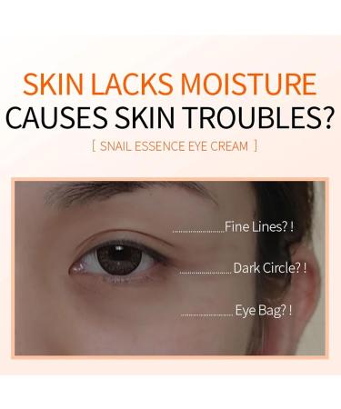 Eye Cream for Dark Circles and Puffy Eyes Snail Eye Cream Eye Bags Remover Eye Cream Anti Aging Under Eye Cream Reduce Lines Wrinkles Puffiness and Dark Circles for All Skin Types - Buy Online on GoSupps.com