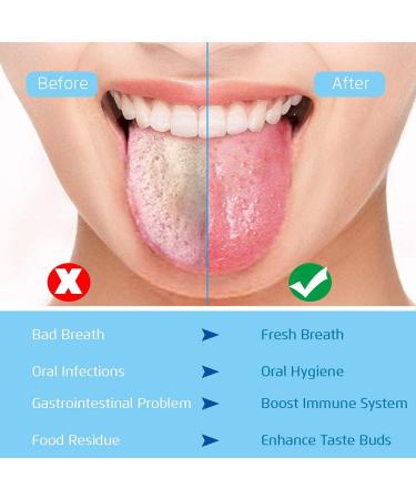 Jamverus 2PCS Reusable Stainless Steel Tongue Scraper Set for Adults & Kids - Medical Grade Oral Hygiene Tools for Fighting Bad Breath - Buy Online on GoSupps.com