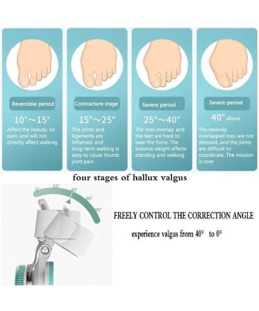 Big Toe Straightener & Bunion Orthosis - Adjustable Splint for Hallux Valgus Correction & Cross Arch Restoration - International Shipping Available - Buy Online on GoSupps.com