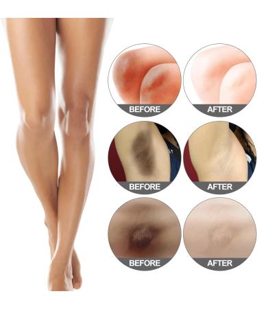 50g*2 Cr me Blanchissante Pour Le Corps Whitening Cream Underarm Whitening Cream Fficace Pour Les Aisselles Les Zones Sensibles Les Coudes Gel claircissante Sous Les Bras - Buy Online on GoSupps.com
