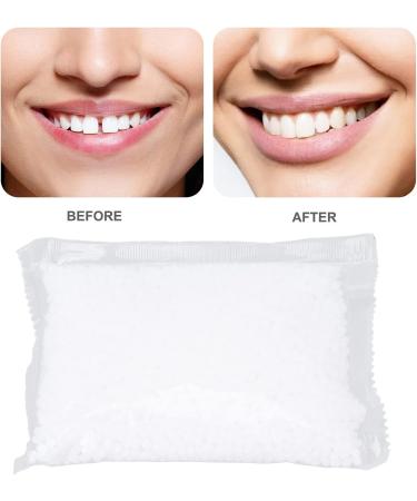 Thermal Fitting Beads for Teeth Repair | 100g Denture Fixation | Perfect for Halloween Party - Buy Online on GoSupps.com