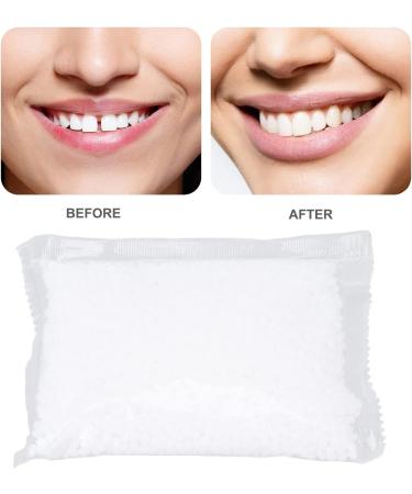 Moldable Thermo Fitting Bead - Temporary Tooth Repair Kit for Halloween Party | 100g Filling Bead Supplies - Buy Online on GoSupps.com