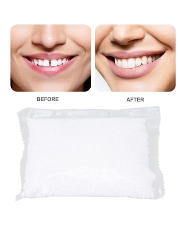 Temporary Tooth Repair Set - 100g | Fix Broken Teeth & Secure Prosthesis | Fast & Easy Dental Solution - Buy Online on GoSupps.com