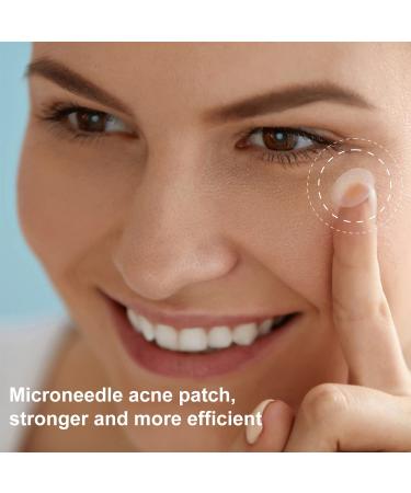 Jonov Acne Pimple Patch - Fast Acting Hydrocolloid Pimple Patches for Night - 18 Blemish Cover Stickers for Face - Buy Online on GoSupps.com