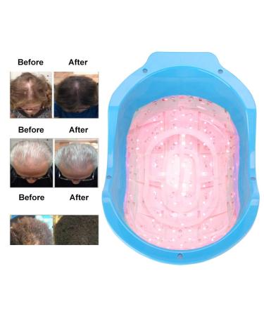 Laser Hair Growth Cap for Men & Women | Anti-Hair Loss Therapy | Strengthens & Volumizes Hair | White Laser Helmet - Buy Online on GoSupps.com