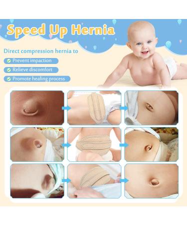 Mybow Umbilical Hernia Belt for Newborns | Baby Belly Button Support Wrap | Medical Abdominal Truss in Beige - Buy Online on GoSupps.com