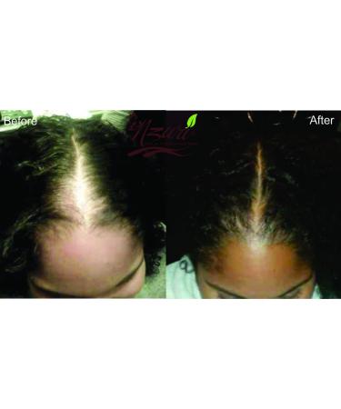 Nzuri Elixir Hair Skin and Nails Vitamins with Vitamin D | 32 oz for Women and Men - Buy Online on GoSupps.com