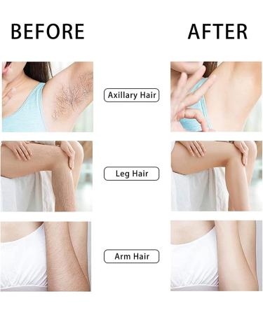 Nano Crystal Hair Remover - Painless Reusable Tool for Women | Hair Removal without Shaving for Legs Arms & Back (Blue) - Buy Online on GoSupps.com