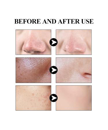 Activated Carbon Facial Mask Stick | Deep Clean & Moisturize with Camellia Seed Oil | Shrink Pores & Remove Acne (1.4oz - Buy Online on GoSupps.com