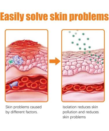 KCRPM Youth Bee Venom Psoriasis Treatment Cream - Soothing & Moisturizing Formula for All Skin Types | 1pcs - Buy Online on GoSupps.com
