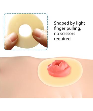 Ostomy Barrier Rings - 10PCs for All Stoma Bags | 4mm Thickness | Secure Fit & Comfort - Buy Online on GoSupps.com