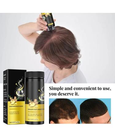 Anti-Hair Failure Ginger Hair Growth Powder - Stimulate Thicker Hair Strengthen Roots & Promote Fast Growth | 3-Pack for Women & Men - Buy Online on GoSupps.com