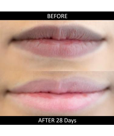Omorfee Organic Lip Lightening Balm | SPF Lip Balm for Dark Lips | Natural Lip Protection & Repair - 10g - Buy Online on GoSupps.com