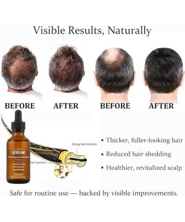 S rum de repousse capillaire Dekohair Soin avanc du cuir chevelu R duit la chute R pare les pointes fourchues et ab m es Cheveux lisses et doux Convient tous types de cheveux 1pcs - Buy Online on GoSupps.com