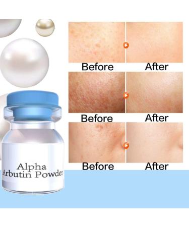 Kybbe Alpha Arbutin Powder Cream Arbutin Whitening Lightening Skin Anti-aging Serum Skin Care 3g - Buy Online on GoSupps.com