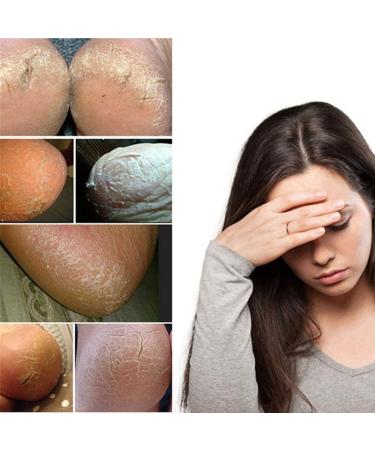 Unisex Moisturizing Heel Socks - Spa Socks for Cracked Dry Skin Care Breathable & Adjustable Foot Protectors for Heel Pain Relief - Buy Online on GoSupps.com