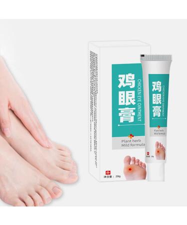 JIEJIEHOUSE Anticallus cream anticorn skin ointment corn remover callus remover foot gel against calluses and corns for women and men 20 g - Buy Online on GoSupps.com