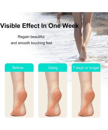 Crystal Foot File - Callus Remover for Feet | Dead Skin Scrubber for Hands & Heels - Pedicure Tool for Men & Women - Buy Online on GoSupps.com