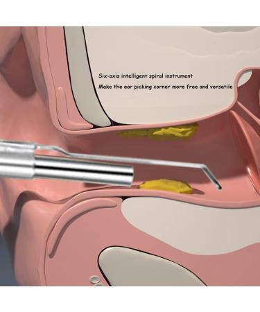 Nautig Ear Wax Removal Camera Kit - Wireless Ear Cleaner with HD Visual Inspection, Multifunctional Ear Scoop and LED Light (Color A) - Buy Online on GoSupps.com