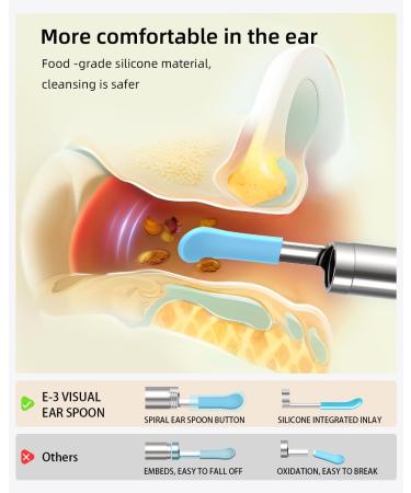 1080P Ear Wax Removal Tool Telescopic Otoscope with 6 LED Lights 7 Ear Picks & 10 Silicone/Metal Spoons International Shipping Available - Buy Online on GoSupps.com