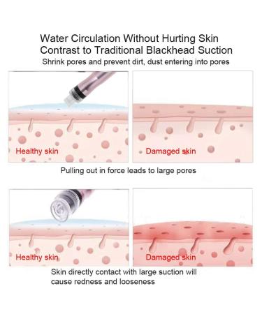 Small Bubbles Facial Suction Machine for Home & Spa | Vacuum Beauty Equipment - Buy Online on GoSupps.com