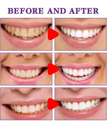 Aibyks Teeth Whitening Toothpaste - Color Toothpaste | 30ML Toothpaste for Removing Teeth Stains Fresh Breath | Oral Cleaning Care Toothpaste for Sensitive Teeth - Buy Online on GoSupps.com