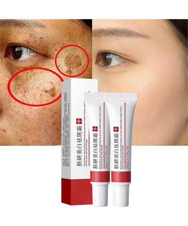 2Pcs Whitening Freckle Cream Acne Scar Removal Treatment Cream Pigmentation Removal Cream for Face Effectively Removes Facial Melasma Dark Spots Blemishes