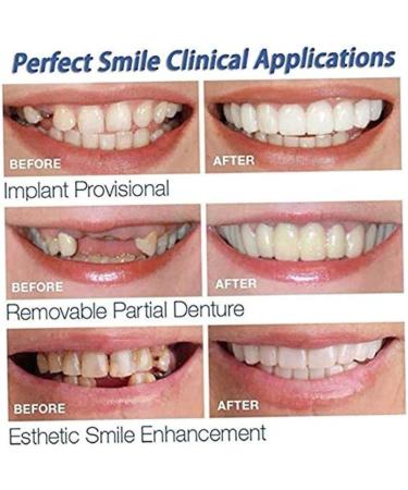 Pastoralist 2 Pairs Dentures Cosmetic Teeth Instant Veneers Temporary Teeth and Bottom Dentures Fit Comfort - Buy Online on GoSupps.com