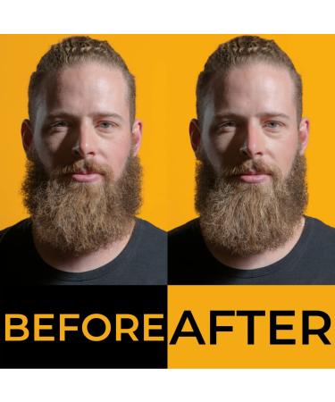 BOSS Beard Oil & Moisturizer - Premium Organic Ingredients | Canadian Made - Masculine Collection - Buy Online on GoSupps.com