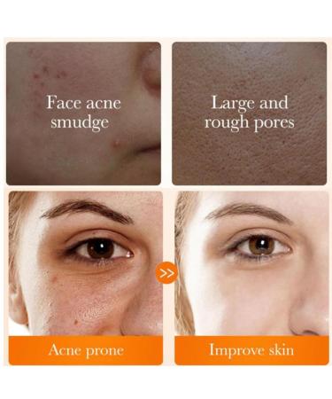 Turmeric Facial Cleanser - Deep Cleansing Foaming Face Wash for All Skin Types - Buy Online on GoSupps.com