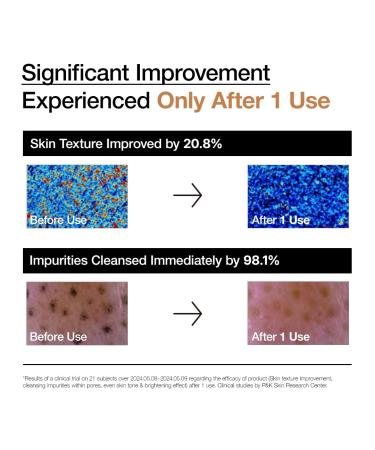 ANUA RICE ENZYME BRIGHTENING CLEANSING POWDER Rice Mask Ceramide Gentle Face Wash for Brightening Radiant Skin Facial Cleanser for Dry Skin Korean Skincare Fragrance Free 40g/1.41fl.oz. - Buy Online on GoSupps.com