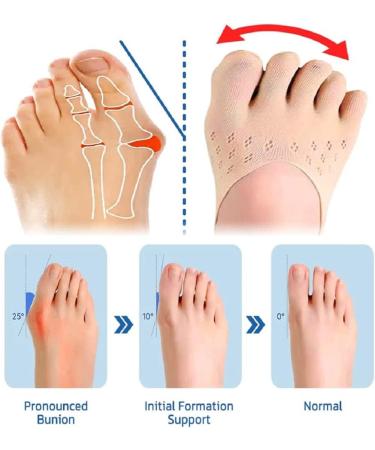 Projoint Antibunions Health Toe Socks - Bunion Corrector for Women and Men (Skin Color) - Buy Online on GoSupps.com